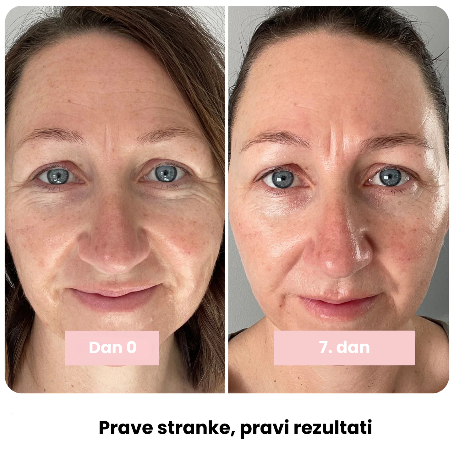 Kolagenska sijajna palčka