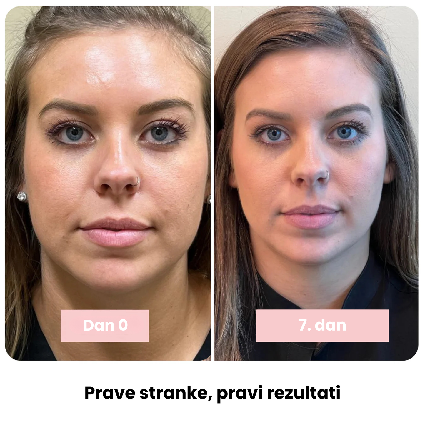 Kolagenska sijajna palčka