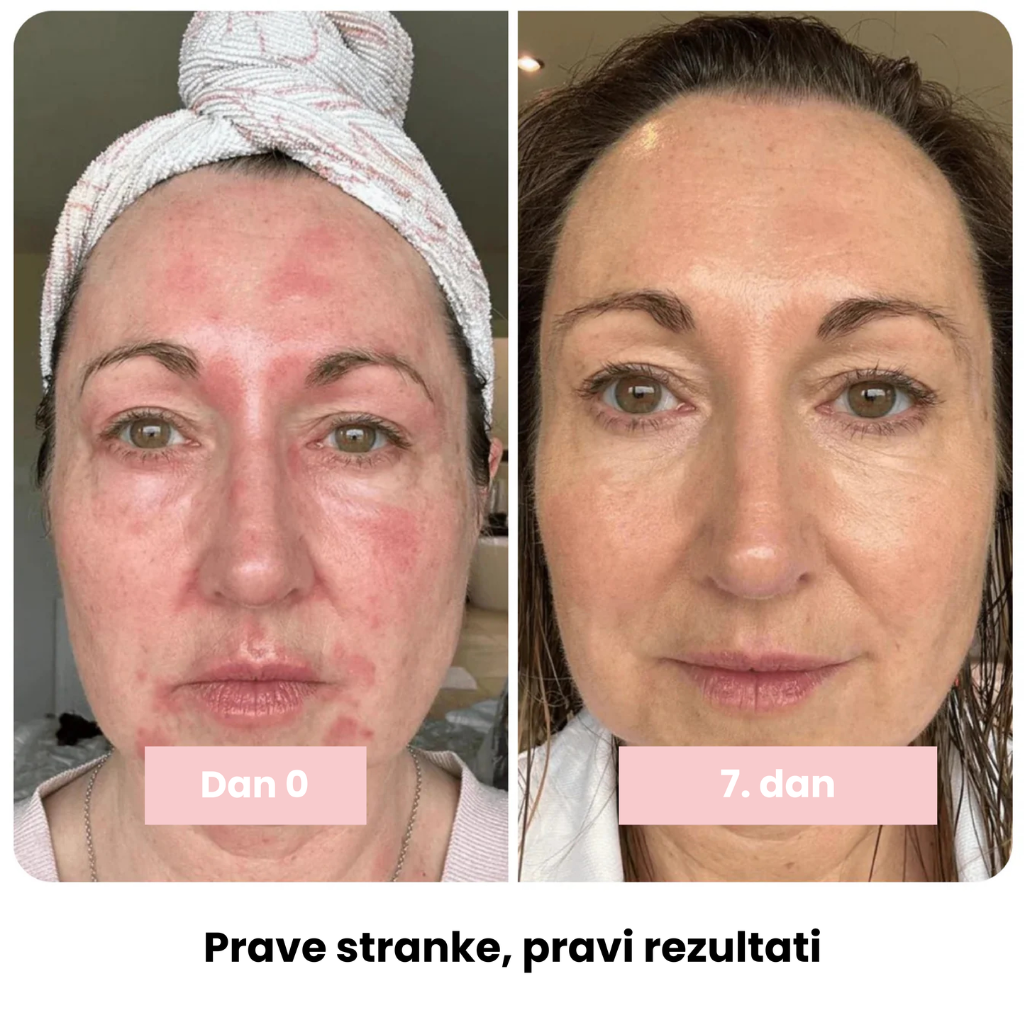 Kolagenska sijajna palčka